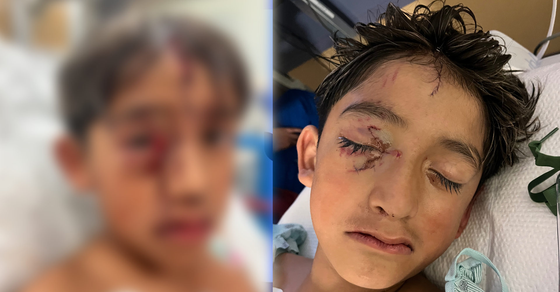 EP-MENOR-ATACADO-POR-PERRO