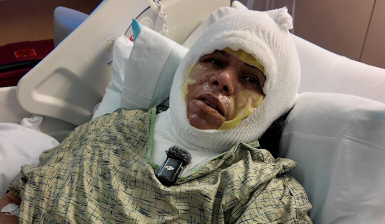 Trágica Explosión en Imperial Beach: Diana Hernández, Madre Soltera, Lucha por su Recuperación
