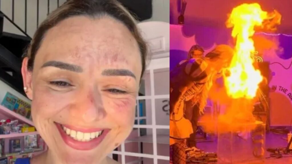 Arlen Hernández: Influencer Sufre Quemadura Facial Por Un 'Pastel Explosivo' - Noticias Notivalle Arlen Hernández: Influencer Sufre Quemadura Facial Por Un ‘Pastel Explosivo’