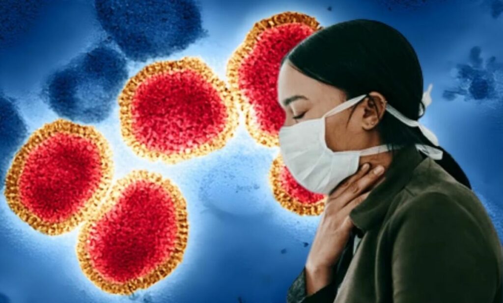 Gripe H3N2 En Palm Springs: Síntomas, Grupos Vulnerables Y Riesgos De Pandemia