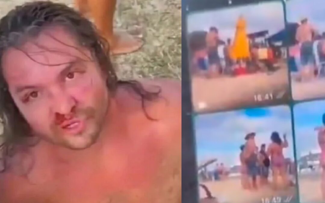 Turista detenido en Palm Springs por grabación sin permiso de mujeres en la playa