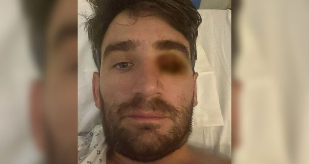 Año Nuevo Trágico: Hombre Pierde Un Ojo Por Explosión De Fuego Pirotécnico - Noticias Notivalle Año Nuevo Trágico: Hombre Pierde Un Ojo Por Explosión De Fuego Pirotécnico