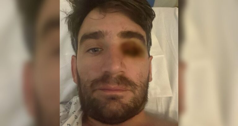 Año Nuevo Trágico: Hombre Pierde un Ojo por Explosión de Fuego Pirotécnico
