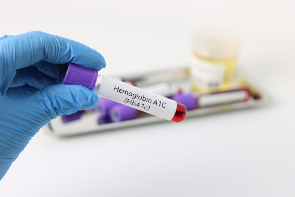 Cruz Roja Americana Ofrece Pruebas Gratuitas De A1C Y Tarjetas De Regalo Durante Marzo