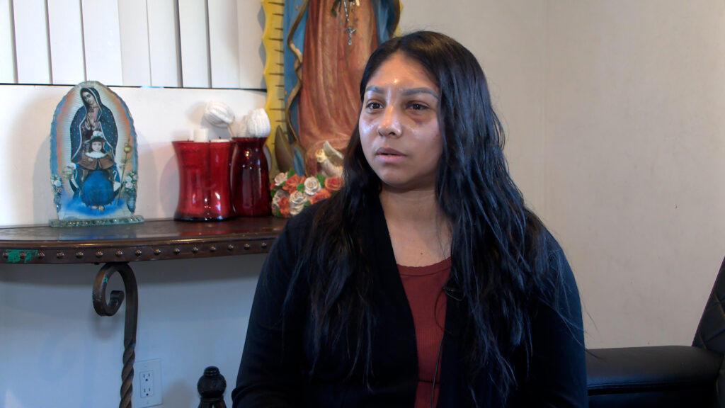 Agresión En Bar En San Diego: Mujer Denuncia Brutal Ataque Durante Una Noche De Diversión