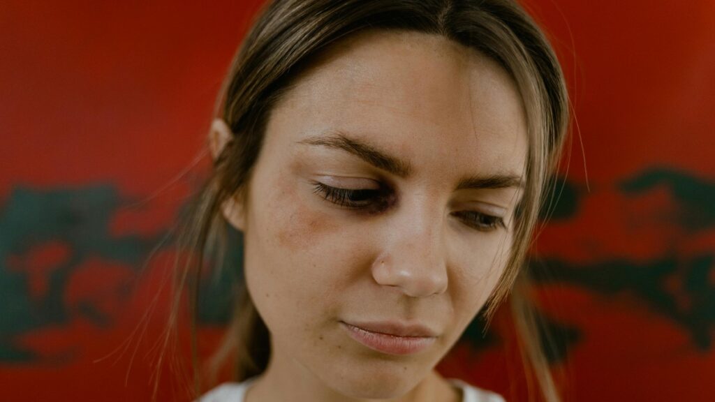 Delitos De Lesiones En Nuevo León: Aumento Impactante En Marzo