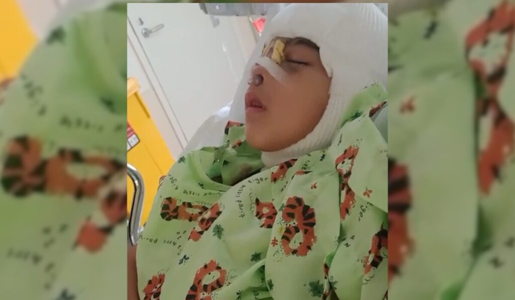 Axel Enfrenta La Displasia Frontonasal Con Cirugía Gratuita Y Apoyo Familiar