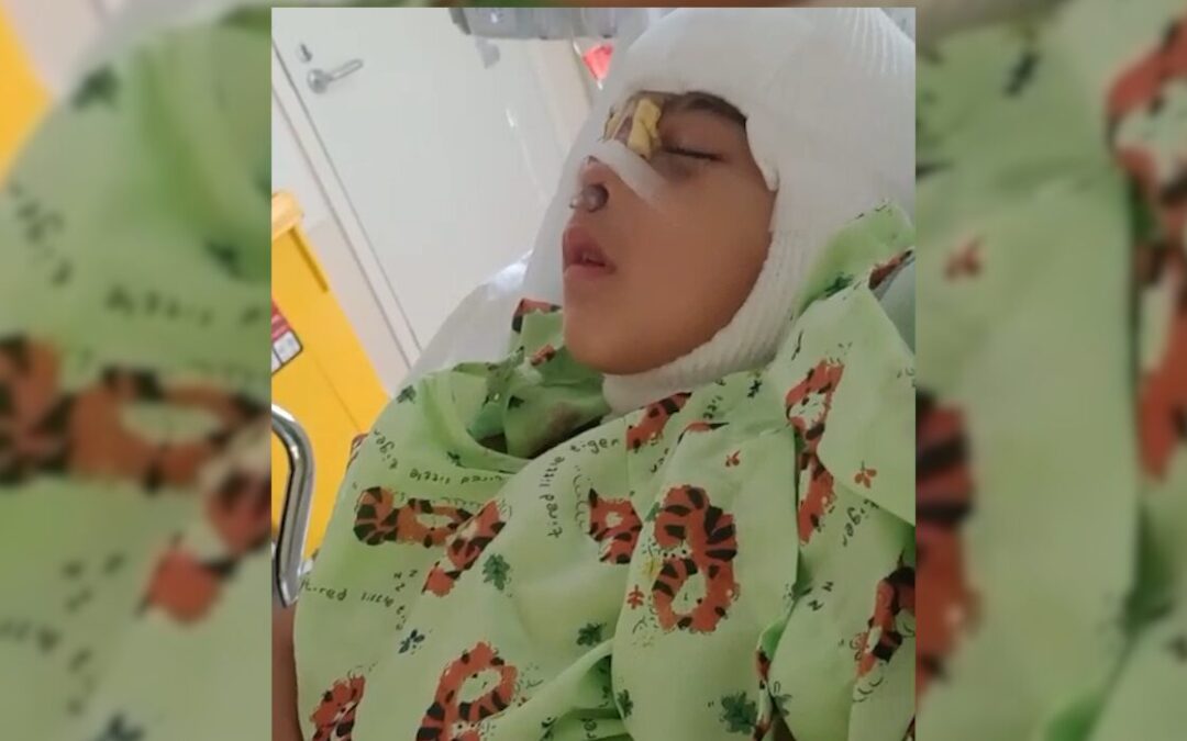 Axel enfrenta la displasia frontonasal con cirugía gratuita y apoyo familiar