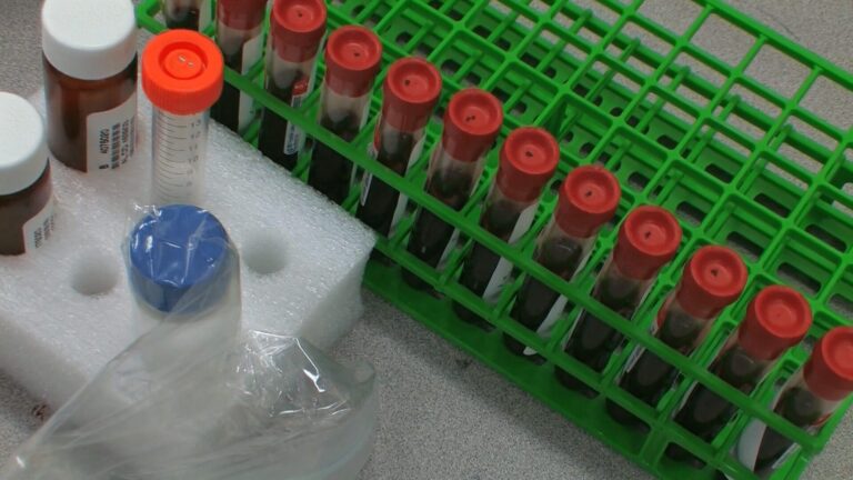 Nuevo análisis de sangre aprobado por la FDA ofrece herramienta clave para la detección temprana del Alzheimer